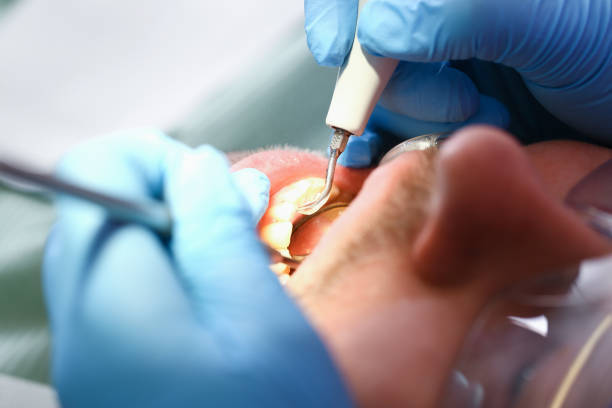 Best Emergency Dental Surgery in Schertz, TX