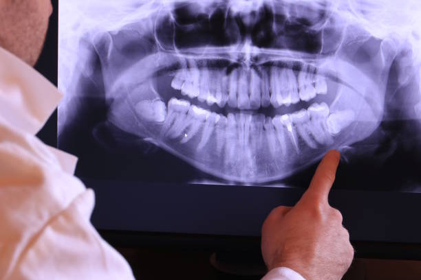 Best Emergency Treatment for Toothache in Schertz, TX