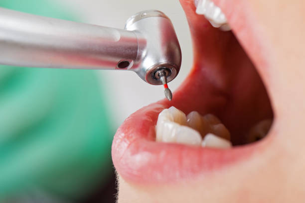Best Weekend Emergency Dentist in Schertz, TX
